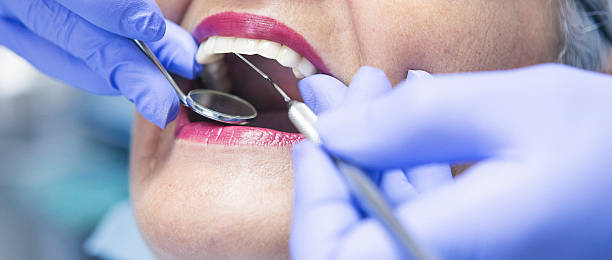 Best Walk-In Emergency Dental Services in Ava, MO